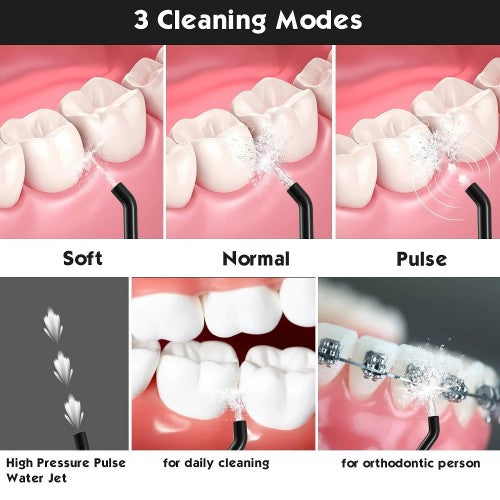 MOSPRO Electric Water Flosser, Dental Oral Irrigator with 4 Jet Tips, 3 Modes, 300ML Water Tank, USB Rechargeable for Teeth, Gums, Braces, Dental Care MOSPRO Electric Water Flosser, Dental Oral Irrigator with 4 Jet Tips, 3 Modes, 300ML Water Tank, USB Rechargeable for Teeth, Gums, Braces, Dental Care